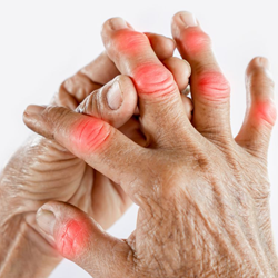 Rheumatology